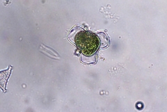 Hyalotheca