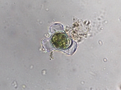 Hyalotheca