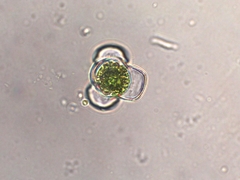Hyalotheca