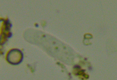 Hartmannellidae