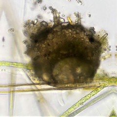 Centropyxis aculeata