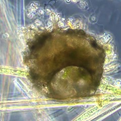 Centropyxis aculeata