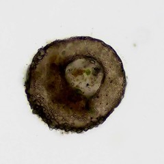 Centropyxis aculeata