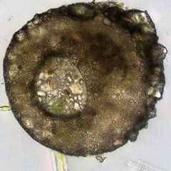 Centropyxis aculeata