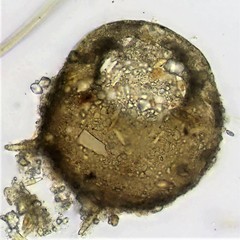 Centropyxis aculeata