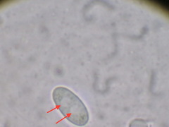 Sclerotinia