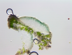 Lecanora gangaleoides