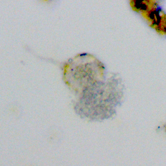 Chytridiomycota