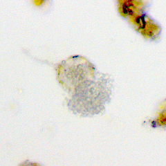Chytridiomycota