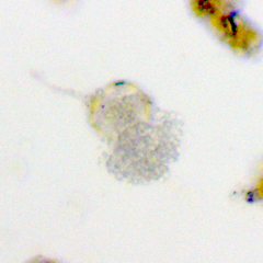 Chytridiomycota
