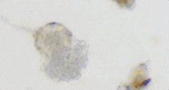 Chytridiomycota