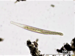 Spirostomum teres
