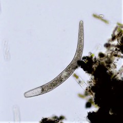 Spirostomum teres