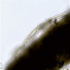 Spirostomum teres