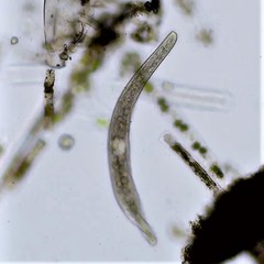 Spirostomum teres