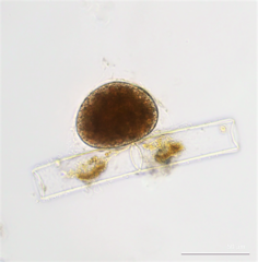 Vampyrella lateritia