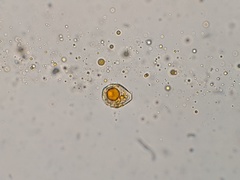 Coleosporium delicatulum