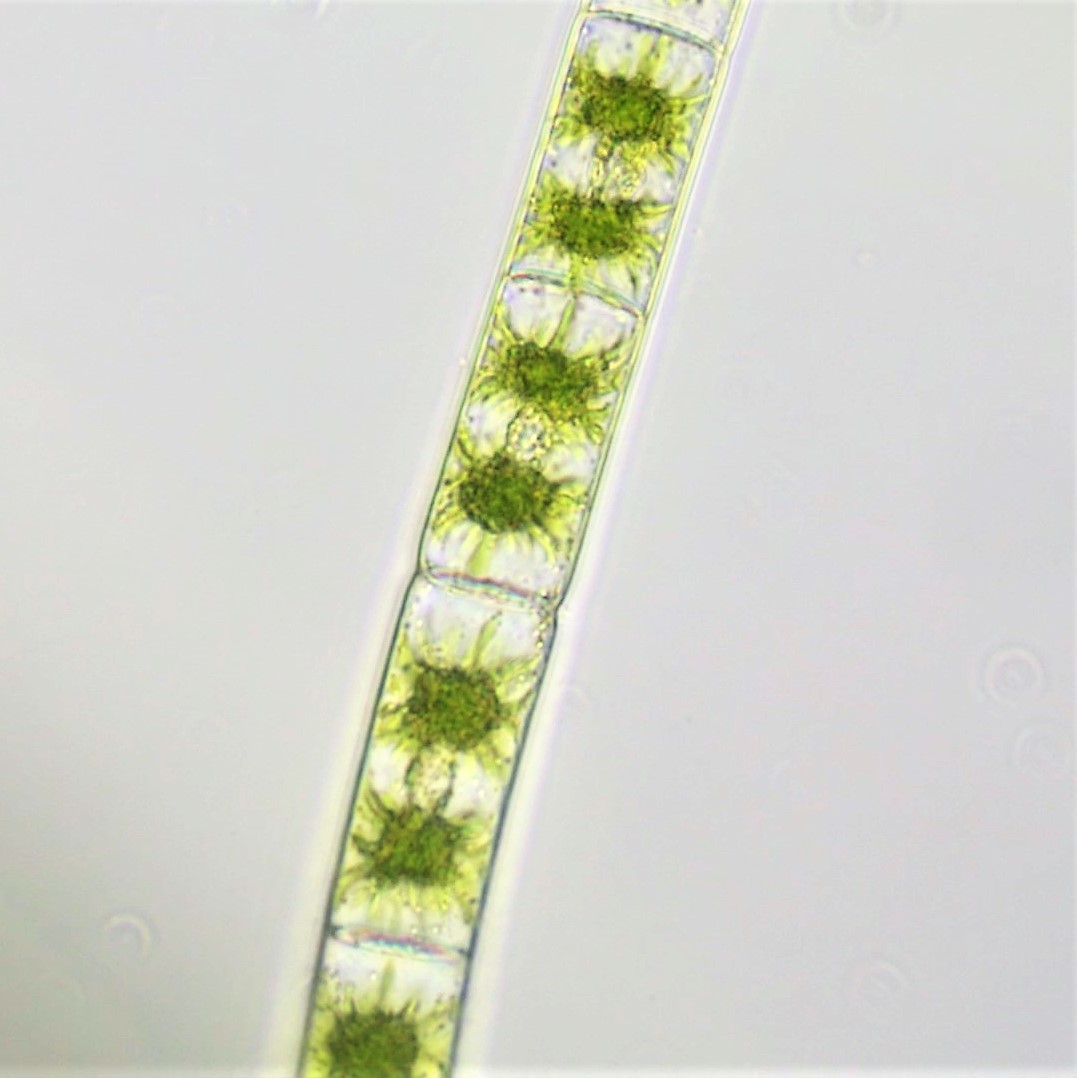 Zygnema