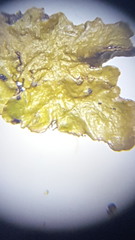 Melanohalea septentrionalis