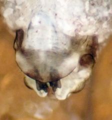 Mesopsocus unipunctatus