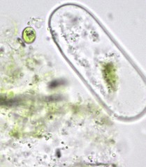 Cylindrocystis