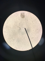 Gastrotricha