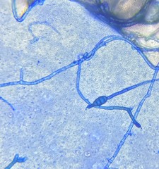 Alternaria alternata