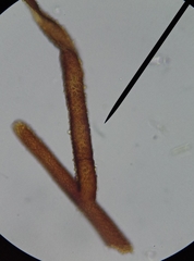 Ptychostomum imbricatulum