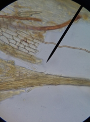 Ptychostomum imbricatulum