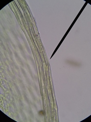 Ptychostomum imbricatulum