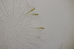 Cyathicula amenti