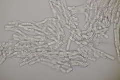 Rhexocercosporidium bellocense