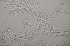 Rhexocercosporidium bellocense