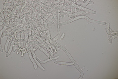 Rhexocercosporidium bellocense