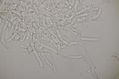 Rhexocercosporidium bellocense