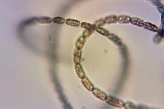 Dolichospermum