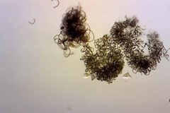 Dolichospermum