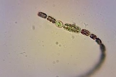 Dolichospermum