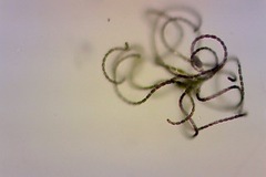 Dolichospermum