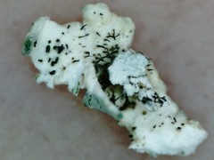 Arctoparmelia centrifuga