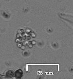 Sphaerocystis