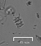 Scenedesmus