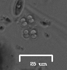 Sphaerocystis