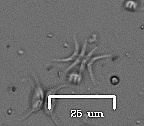 Scenedesmus
