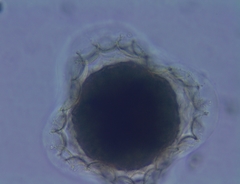 Sphaerocarpos michelii