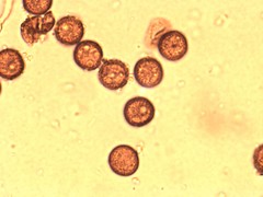 Willkommlangea reticulata