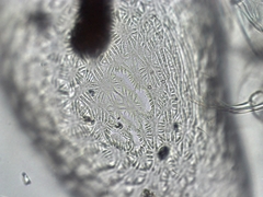 Cyprididae
