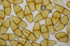 Puccinia liliacearum