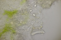 Entyloma ranunculorum