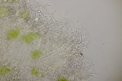 Entyloma ranunculorum